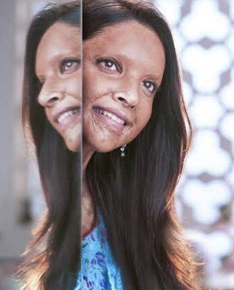 Splash (Chhapaak)